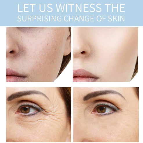 POSH Pore-Refining Treatment Gel (Niacinamide + Witch-hazel)