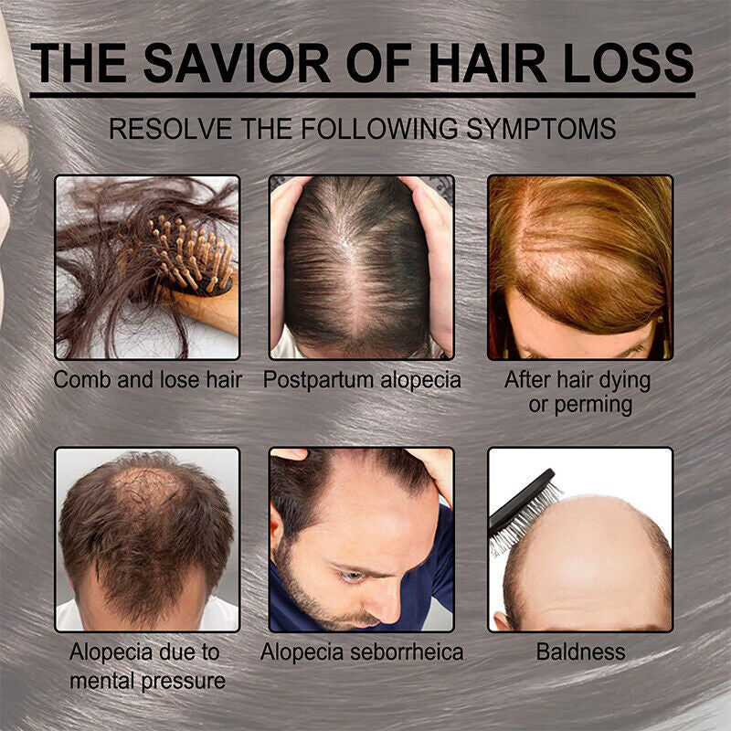 POSH Anti Hair Loss + Hair Regrowth Oil