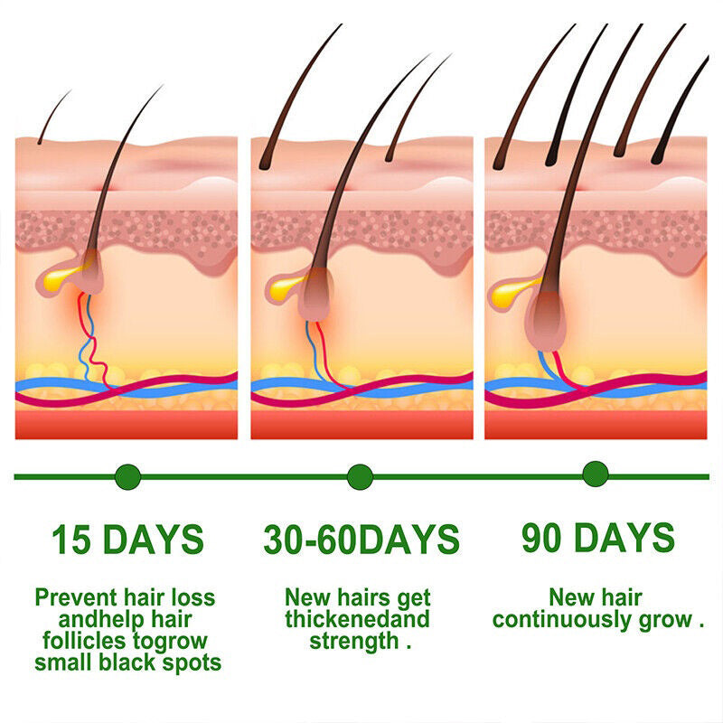 POSH Anti Hair Loss + Hair Regrowth Oil