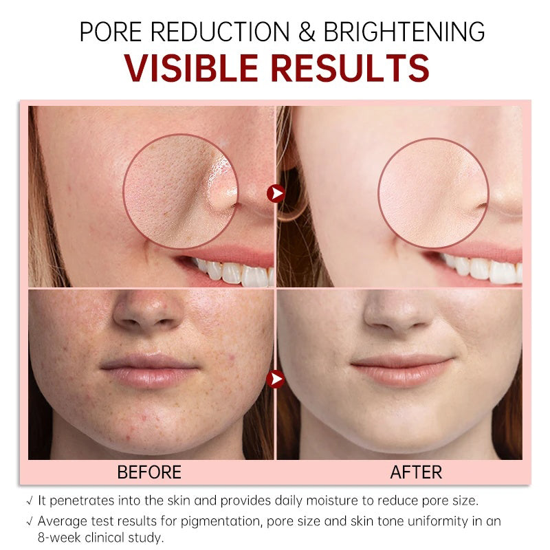 POSH Pore-Refining Treatment Gel (Niacinamide + Witch-hazel)
