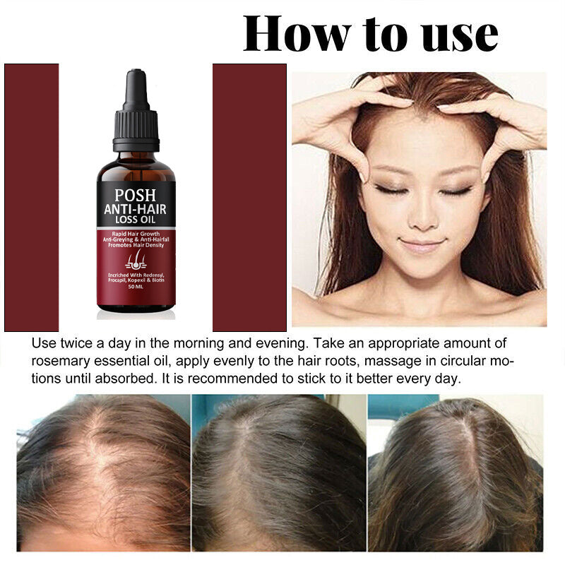 POSH Anti Hair Loss + Hair Regrowth Oil