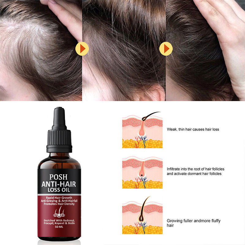 POSH Anti Hair Loss + Hair Regrowth Oil