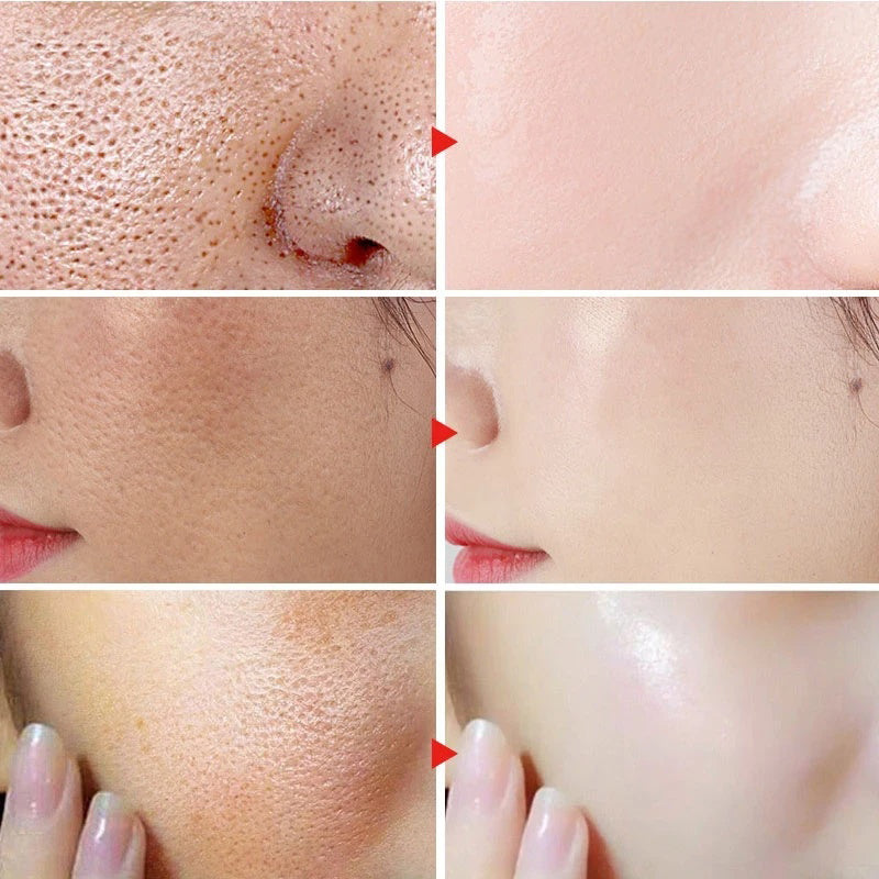 POSH Pore-Refining Treatment Gel (Niacinamide + Witch-hazel)