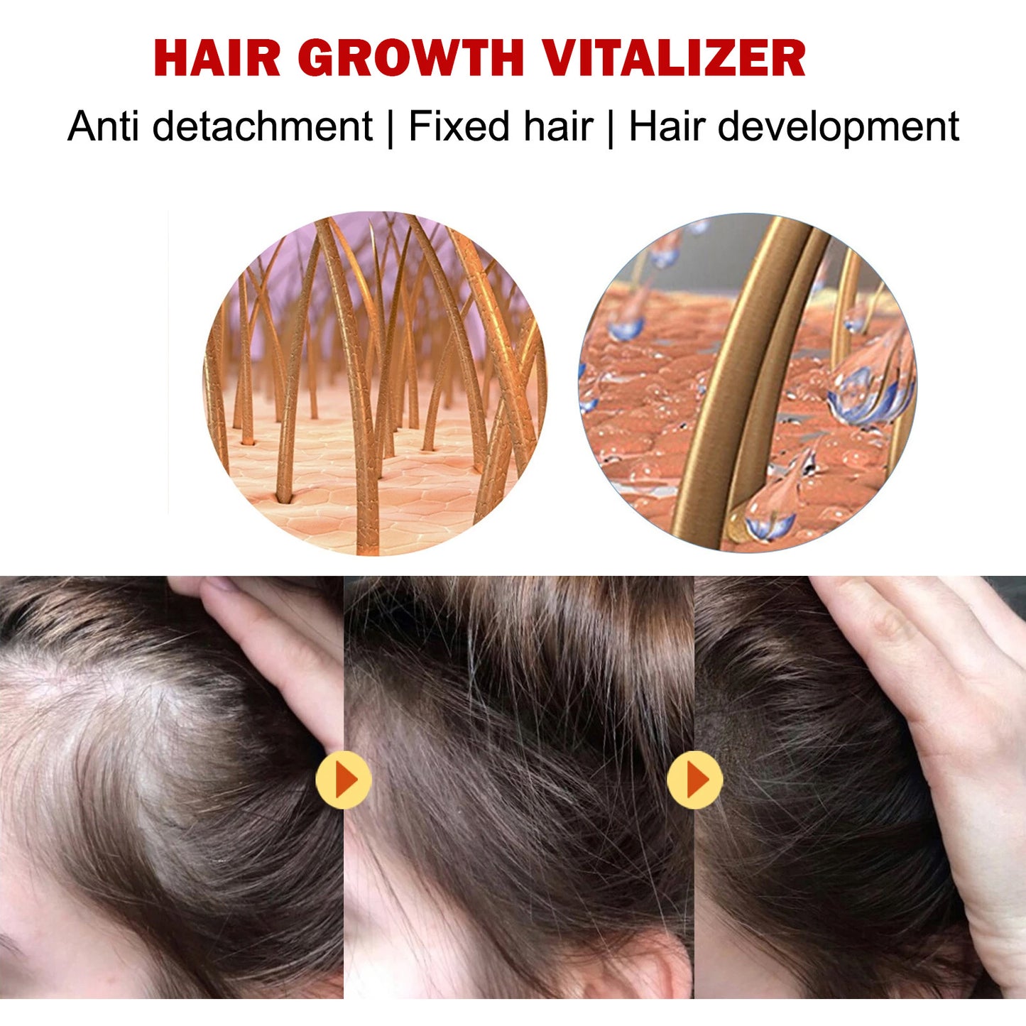 POSH Tonic Vitalizer For Hair Growth and Cell Damage Repair For all Hair Types