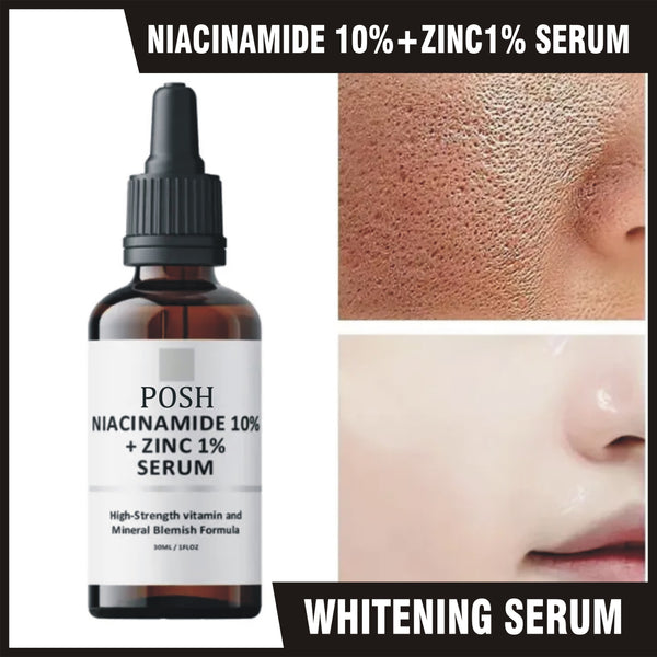 POSH Niacinamide 10% + Zinc 1% Radiance Boost Serum Formula for Clear and Glowing Skin