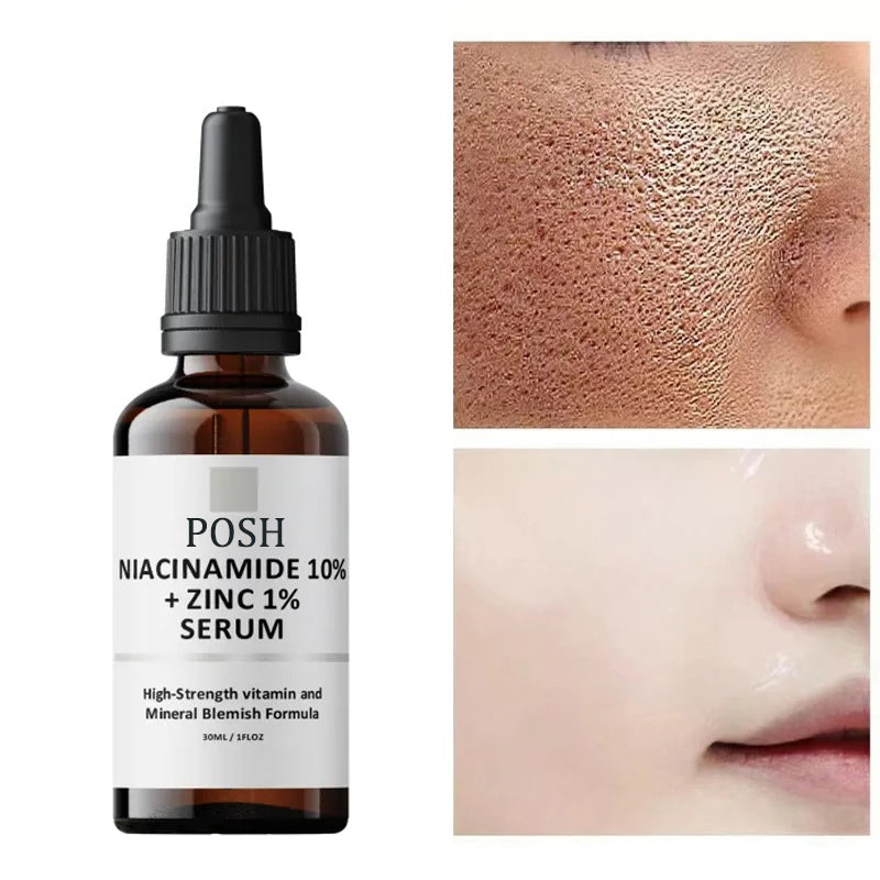 POSH Niacinamide 10% + Zinc 1% Radiance Boost Serum Formula for Clear and Glowing Skin