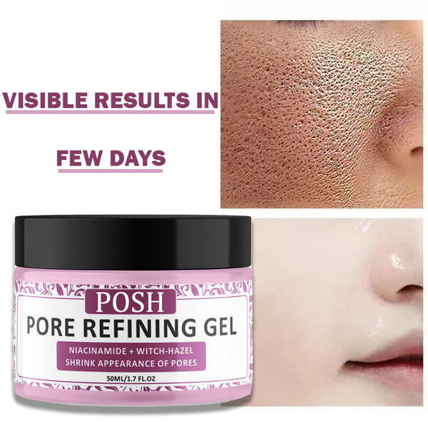 POSH Pore-Refining Treatment Gel (Niacinamide + Witch-hazel)