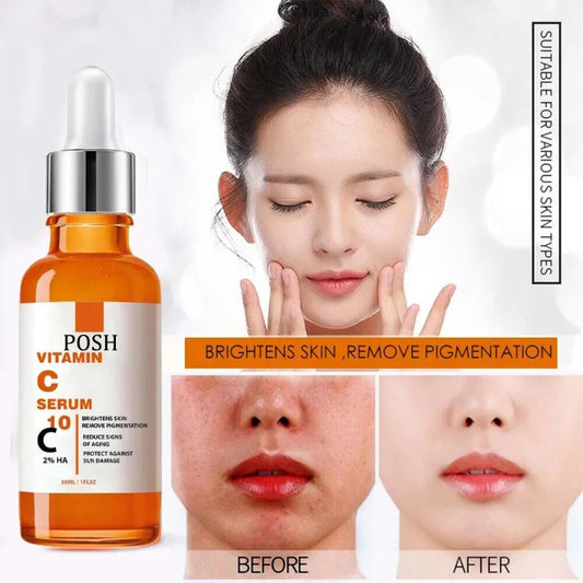POSH Vitamin C Brightening Serum for Face – Anti Aging Face Serum – Brightening Serum for Dark Spots, Even Skin Tone, Eye Area, Fine Lines & Wrinkles for all skin types