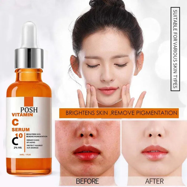 POSH Vitamin C Brightening Serum for Face – Anti Aging Face Serum – Brightening Serum for Dark Spots, Even Skin Tone, Eye Area, Fine Lines & Wrinkles for all skin types