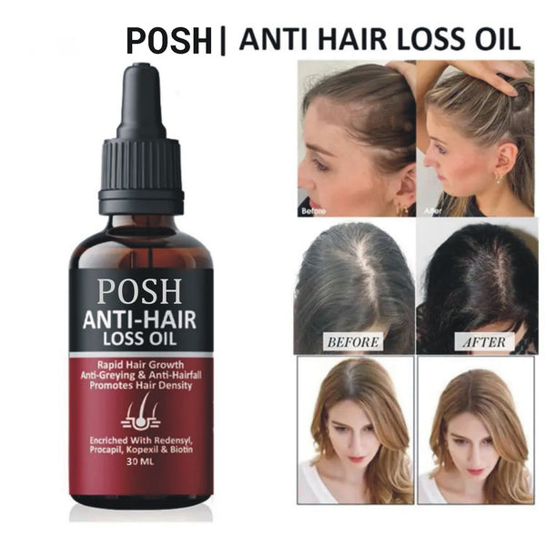 POSH Anti Hair Loss + Hair Regrowth Oil