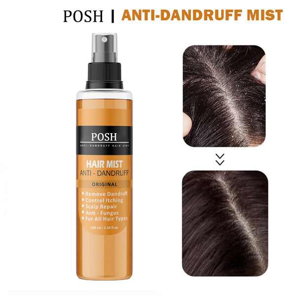 POSH Anti Dandruff Hair Mist For Dandruff Removal and Itching Control For all Hair types