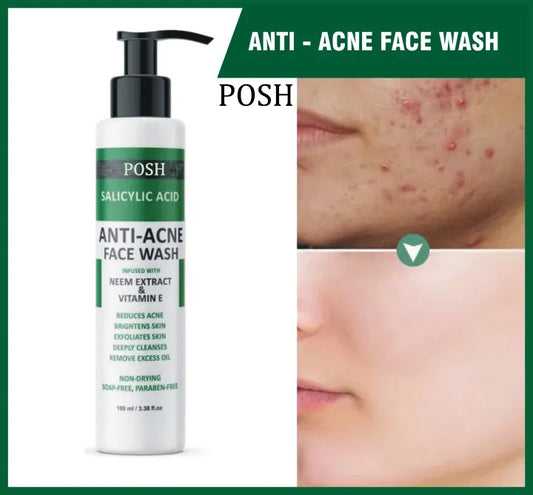 POSH Anti Acne Face Wash – Prevents Acne Eruptions, Removes Excess Oil, Reduces Blackheads & Whiteheads