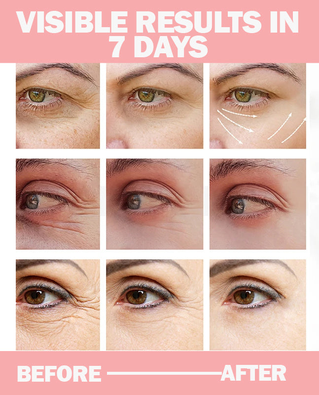 POSH Dark Circles Under Eye Gel For Brighter and Shiner Eyes